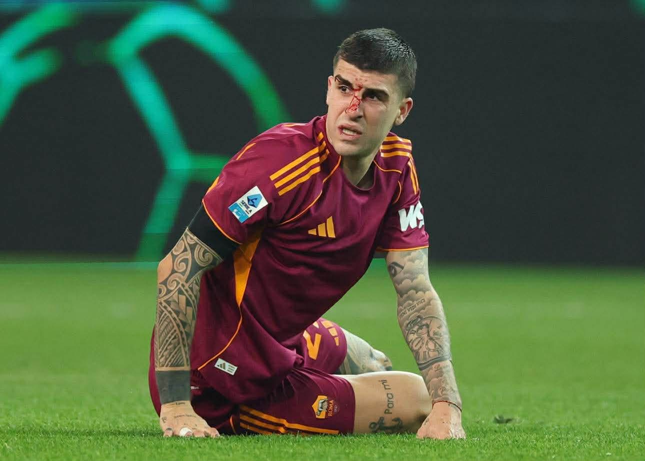 Intervento per frattura al naso per Mancini: potrà tornare in campo subito ma con una maschera protettiva